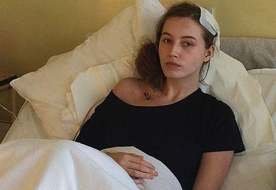 بولندية تستعيد وعيها أثناء جراحة في الدماغ