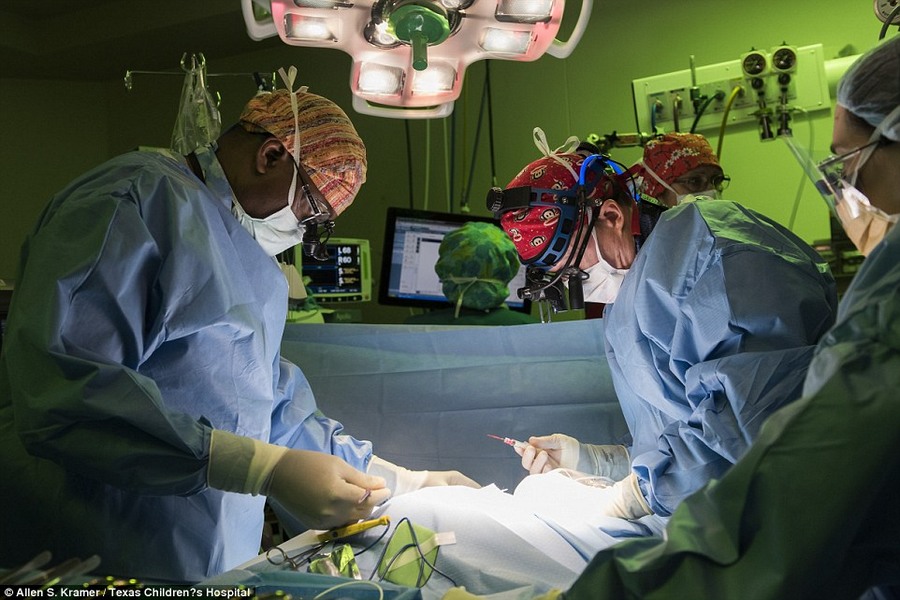 طفلتان سياميتان (10 أشهر) تجتازان بنجاح أول عملية من نوعها لفصلهما