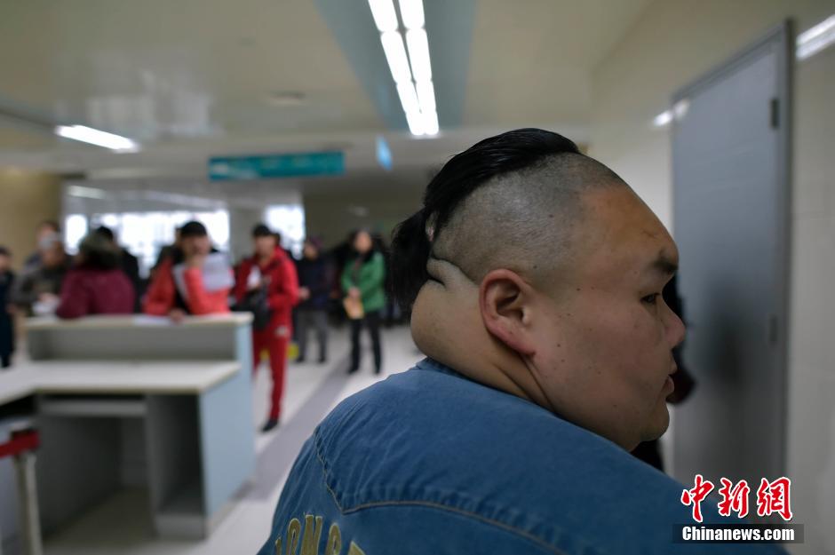 قصة بالصور:"أسمن رجل فى الصين" ينجح في تخفيف وزنه