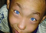 نادر..صبي صيني ذو "عين القط" الزرقاء