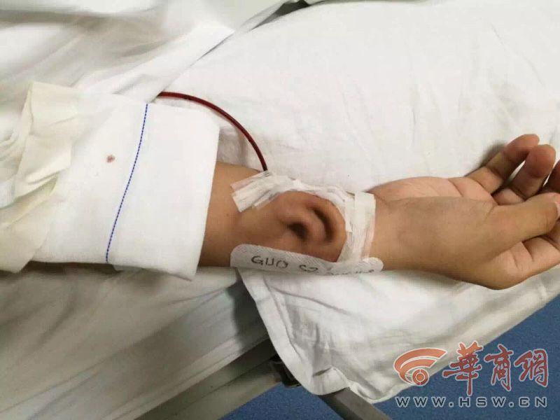 طبيب صيني يعيد بناء أذن جديدة مع الضلع