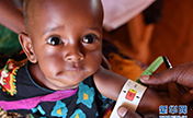 الصين تتبرع بالأموال لليونيسف لمساعدة الأطفال الصوماليين