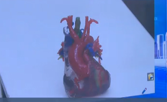 الطباعة ثلاثية الأبعاد تقتحم أمراض القلب