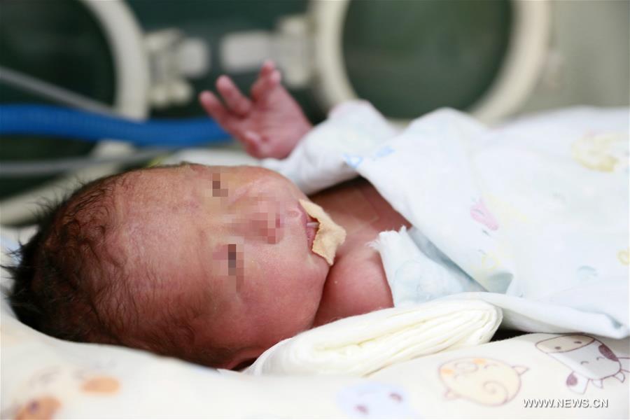 ولادة طفل من رحم مزروع في شمال غربي الصين