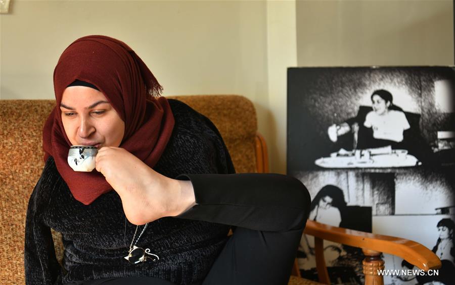 تحقيق إخباري : شابة سورية من ذوي الاحتياجات ترسم لوحات برجليها تعكس من خلالها روحها الجميلة