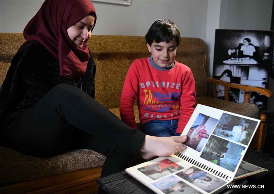 تحقيق إخباري : شابة سورية من ذوي الاحتياجات ترسم لوحات برجليها تعكس من خلالها روحها الجميلة