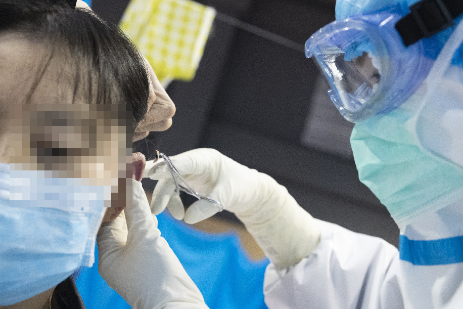  العلاج بالطب التقليدي الصيني في مستشفى مؤقت بمدينة ووهان