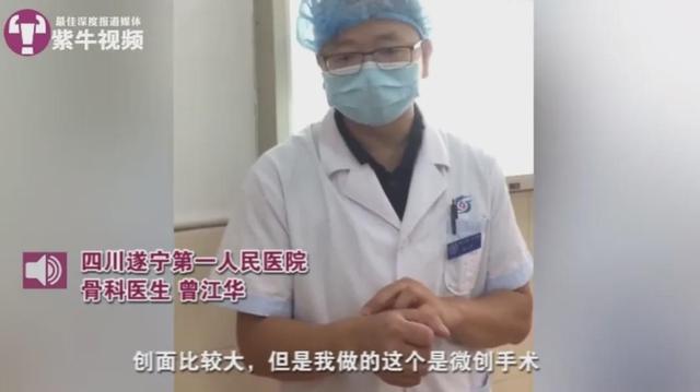 طبيب صيني يجرى جراحة لنفسه