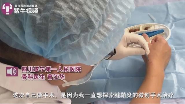 طبيب صيني يجرى جراحة لنفسه